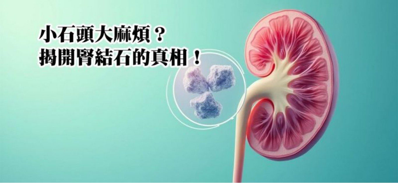 腎結石的真相