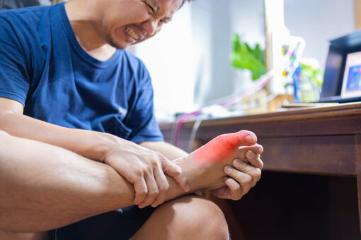 痛風 gout
