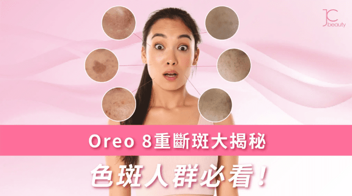 OREO 8重斷斑療程