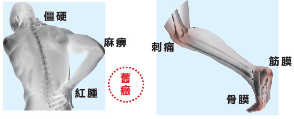 骨頭痛到想罵人？