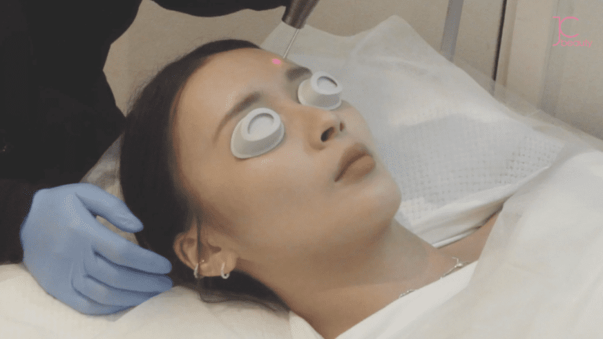 為何你的色斑總是頑固難退？拆解色斑的類型與成因