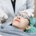 Pico激光去斑終極指南