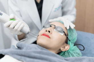 Pico激光去斑終極指南