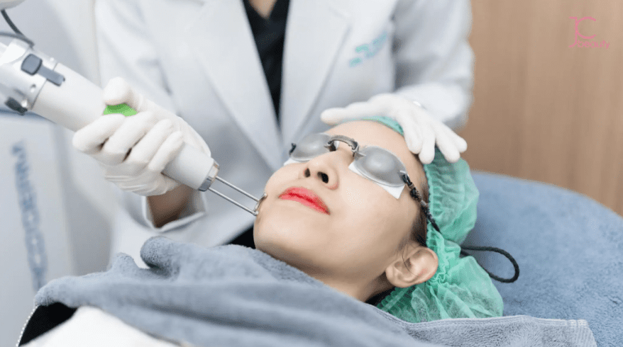 Pico激光去斑終極指南