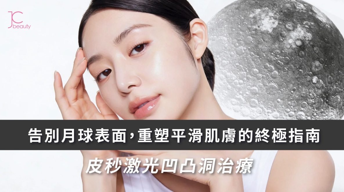 皮秒激光凹凸洞治療