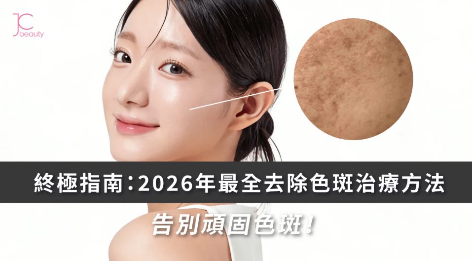 2026去斑方法終極指南 | 告別荷爾蒙斑、反黑的色斑治療全攻略