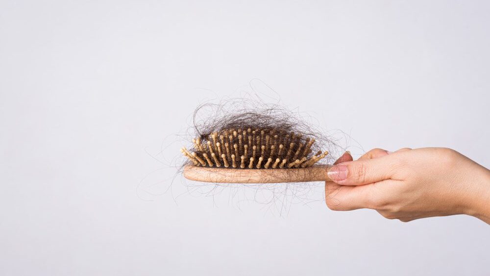 驚人掉髮量:梳頭見到「成堆草」?小心缺鐵